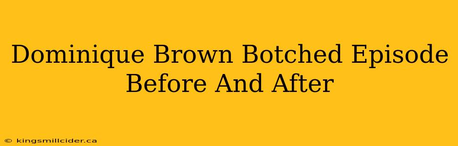 Dominique Brown Botched Episode Before And After