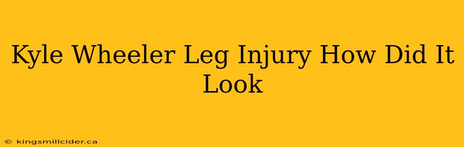 Kyle Wheeler Leg Injury How Did It Look