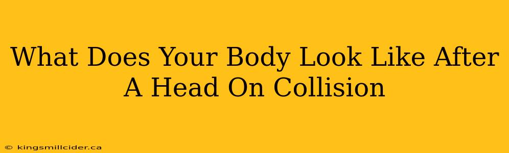 What Does Your Body Look Like After A Head On Collision