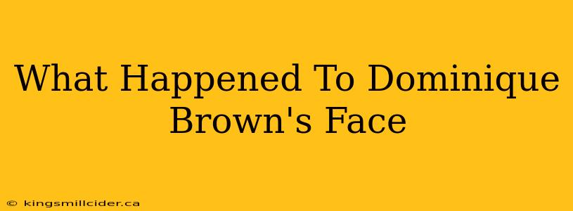 What Happened To Dominique Brown's Face